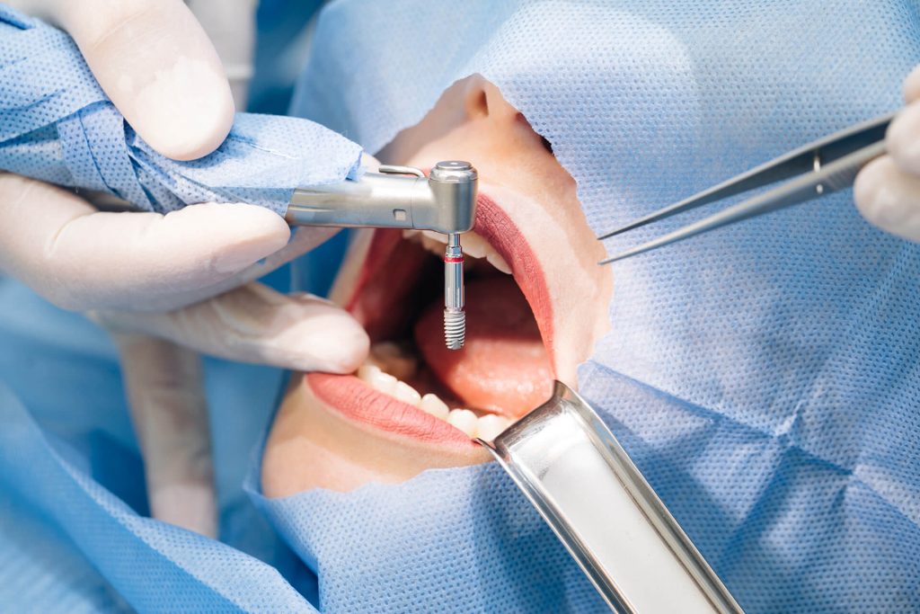 Oral Surgery Arlington VA