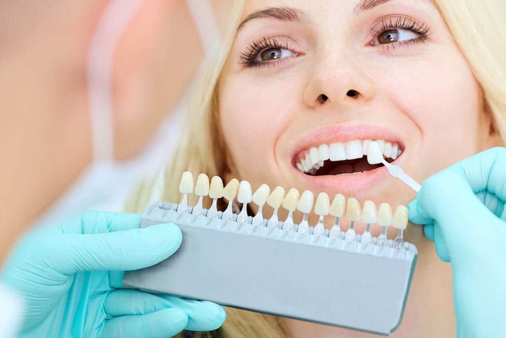 Composite Dental Bonding